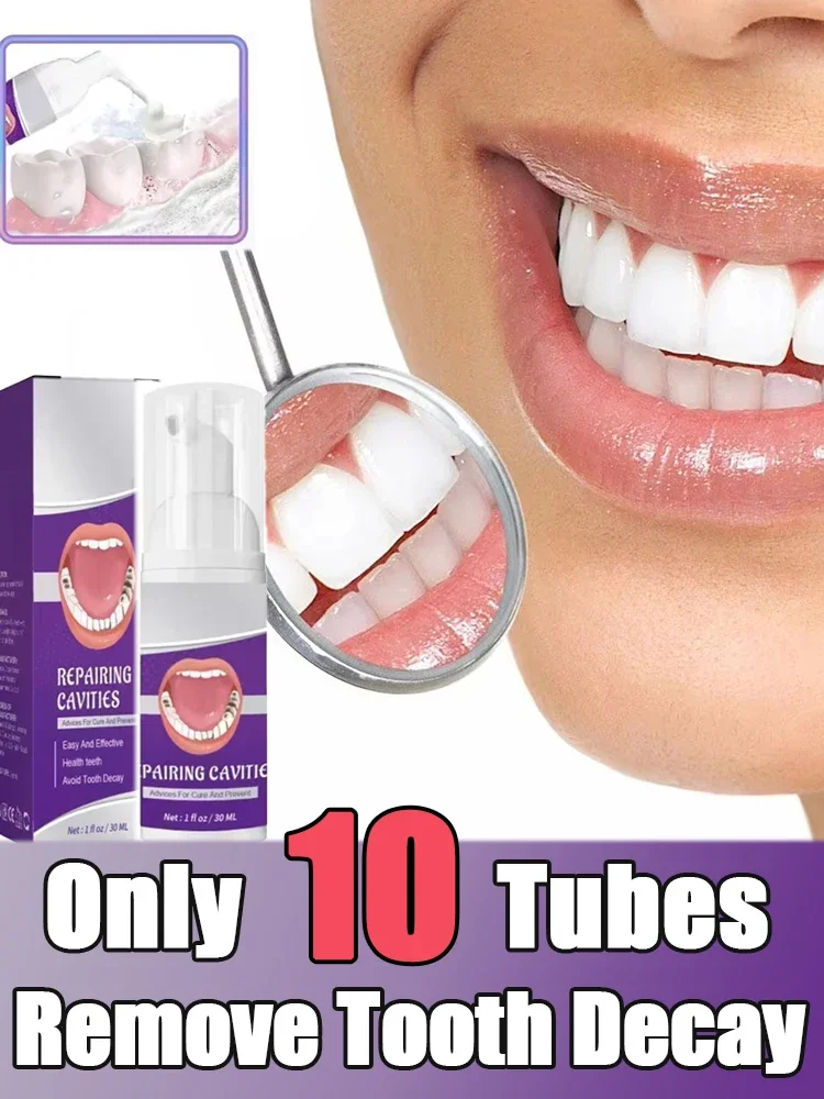 

Oral Hygiene Teeth Cleaning Whitening Teeth Stains Alculus Plaque Periodontitis Freshen Bad Breath Remove Cavities Toothpaste