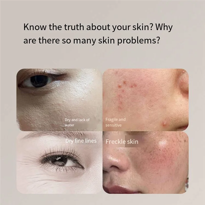 ใหม่เครื่องตรวจจับผิวแบบพกพาใช้งานง่ายFacial Testerเครื่องตรวจจับผิวน้ํามันเครื่องวิเคราะห์สําหรับร้านเสริมสวยสปาHomea52q