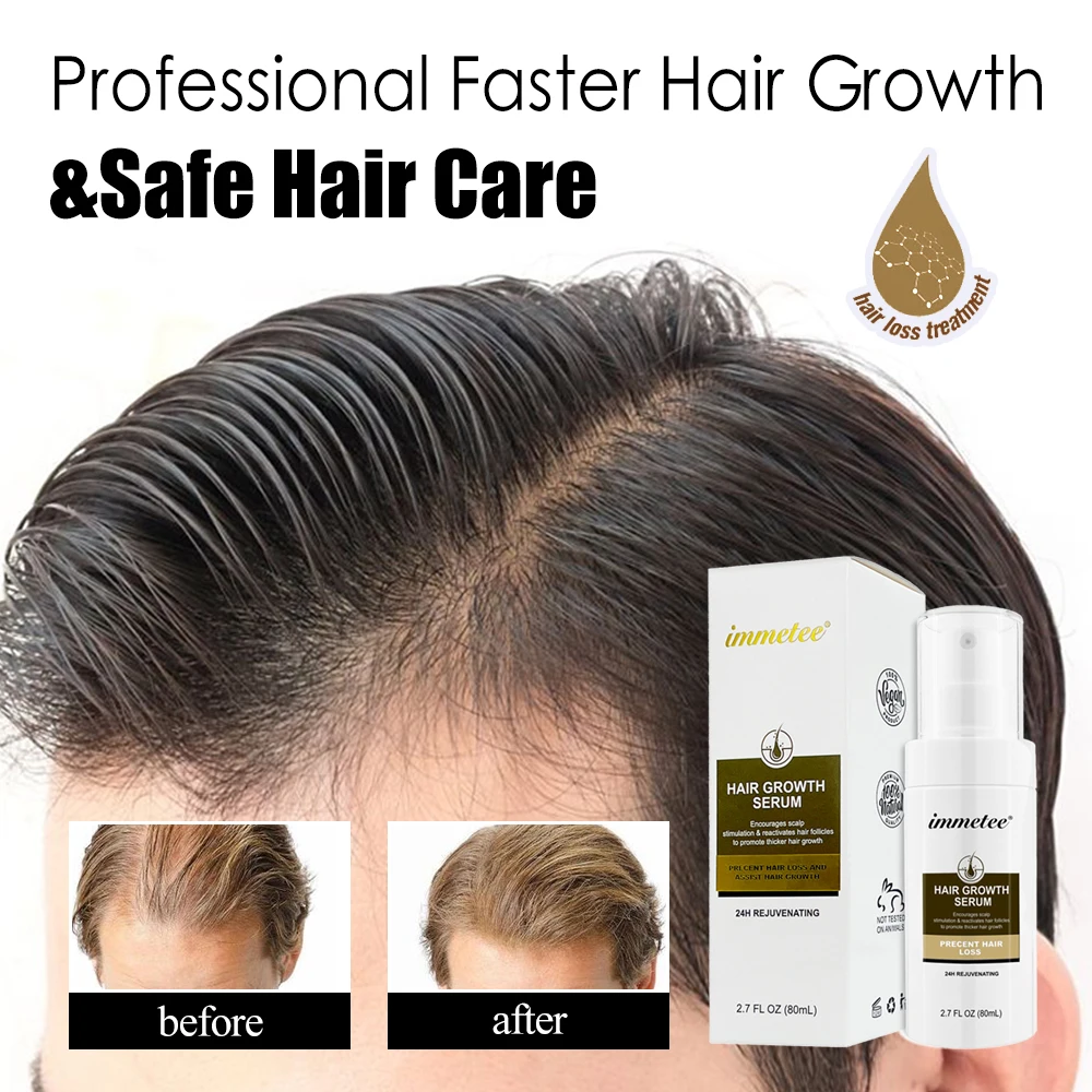 

Anti Hair Loss Nourish Help for Hair Growth Longer Thick Hair Regrowth Essence Hair Care Spray Products Prevent Baldness