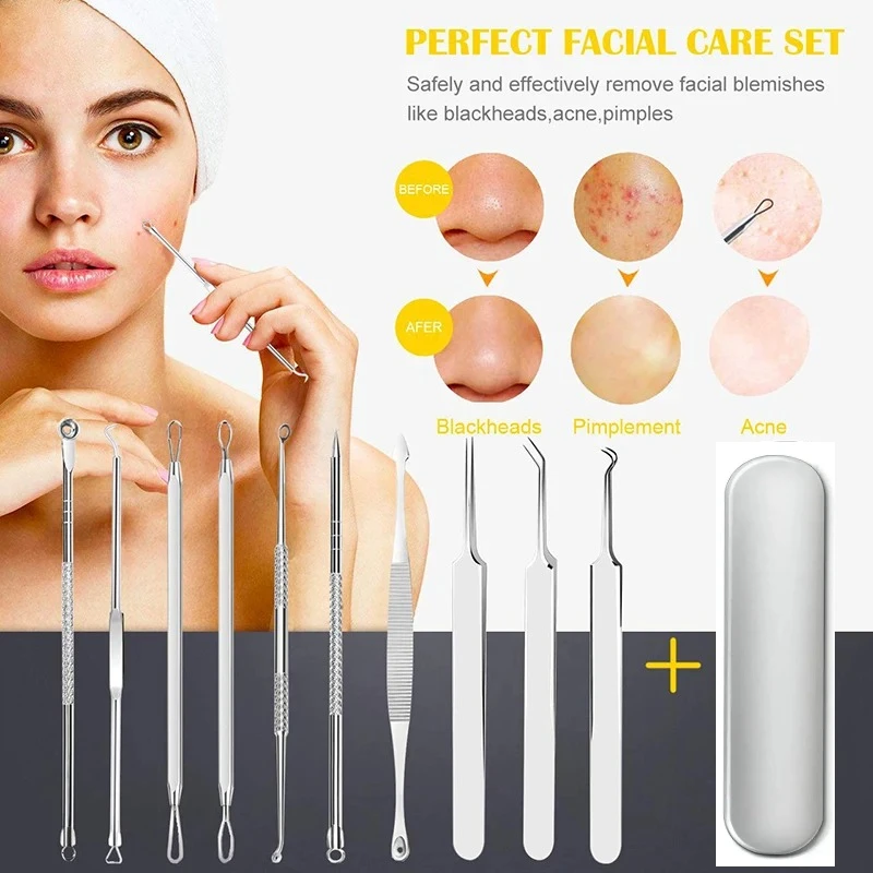 Mee-eter verwijderaar 10 stuks Professioneel puistje Comedo Extractor Tool Acne Removal Kit - Behandeling voor puistjes, mee-eters, Z