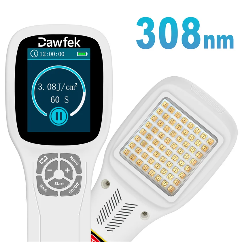 Narrow Band Lamp UVB Vitiligo UV Light Therapy 308nm for Eczema Led Light for Psoriasis Dermatitis Skin Conditions At Home