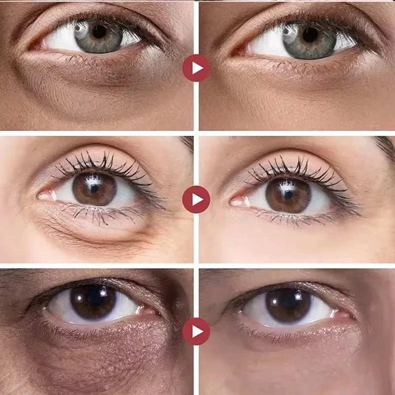 Fett Granulat Entferner Augen Creme Anti-Puffiness verblassen feine Linien Augenringe Augen beutel reparieren Gel straffende feuchtigkeit spendende