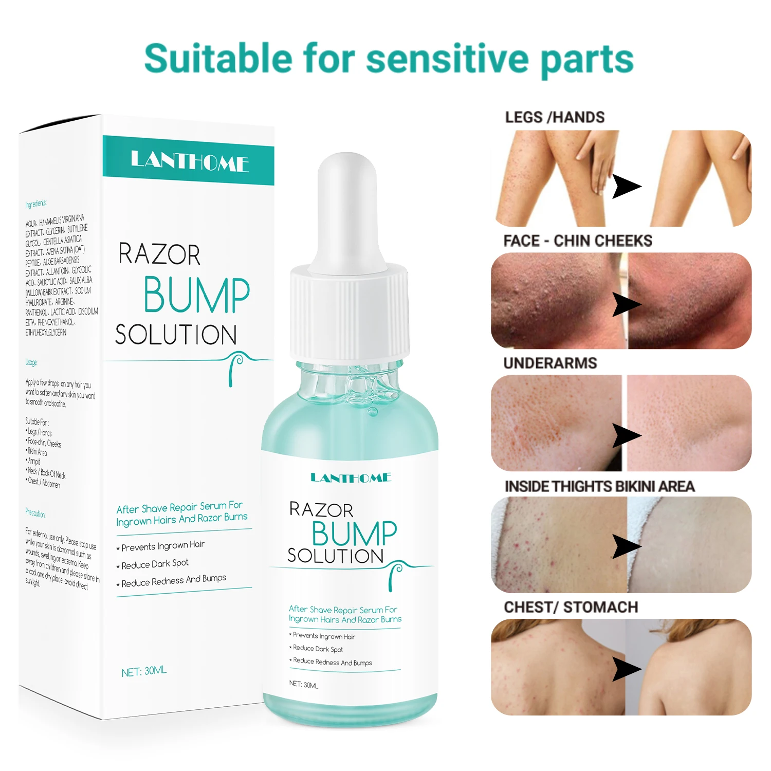 Lanthome Razor Bumps Removal Solution For Hair treatment After Shave Repair Dark Spot Reduce Redness Serum for vanish Skin Care