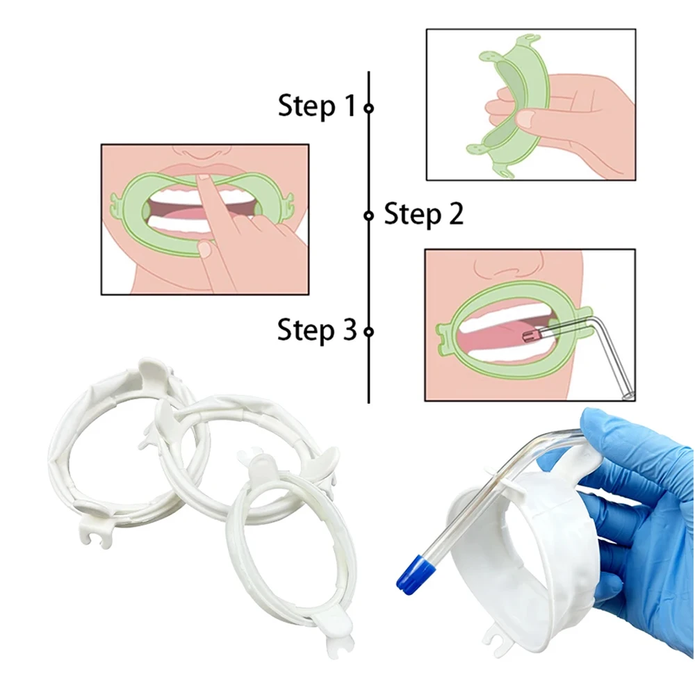 O Shape Mouth Opener with Lip and Cheek Retraction for Dental Exams and Treatments