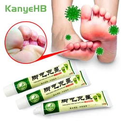 3pcs Foot Tinea Pedis Treatment Cream Treat Beriberi Ointment Anti-itch Inhibits Fungus Peeling Athlete Foot Medical Cream A942