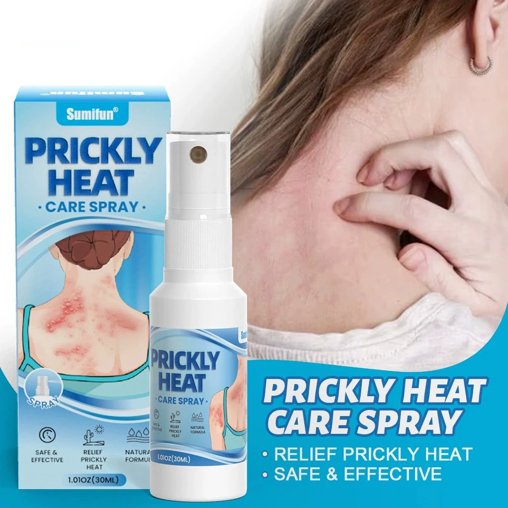 

Спрей для ухода за колючим теплом Спрей против зуда для ухода за кожей Спрей для теплоотдачи K50029