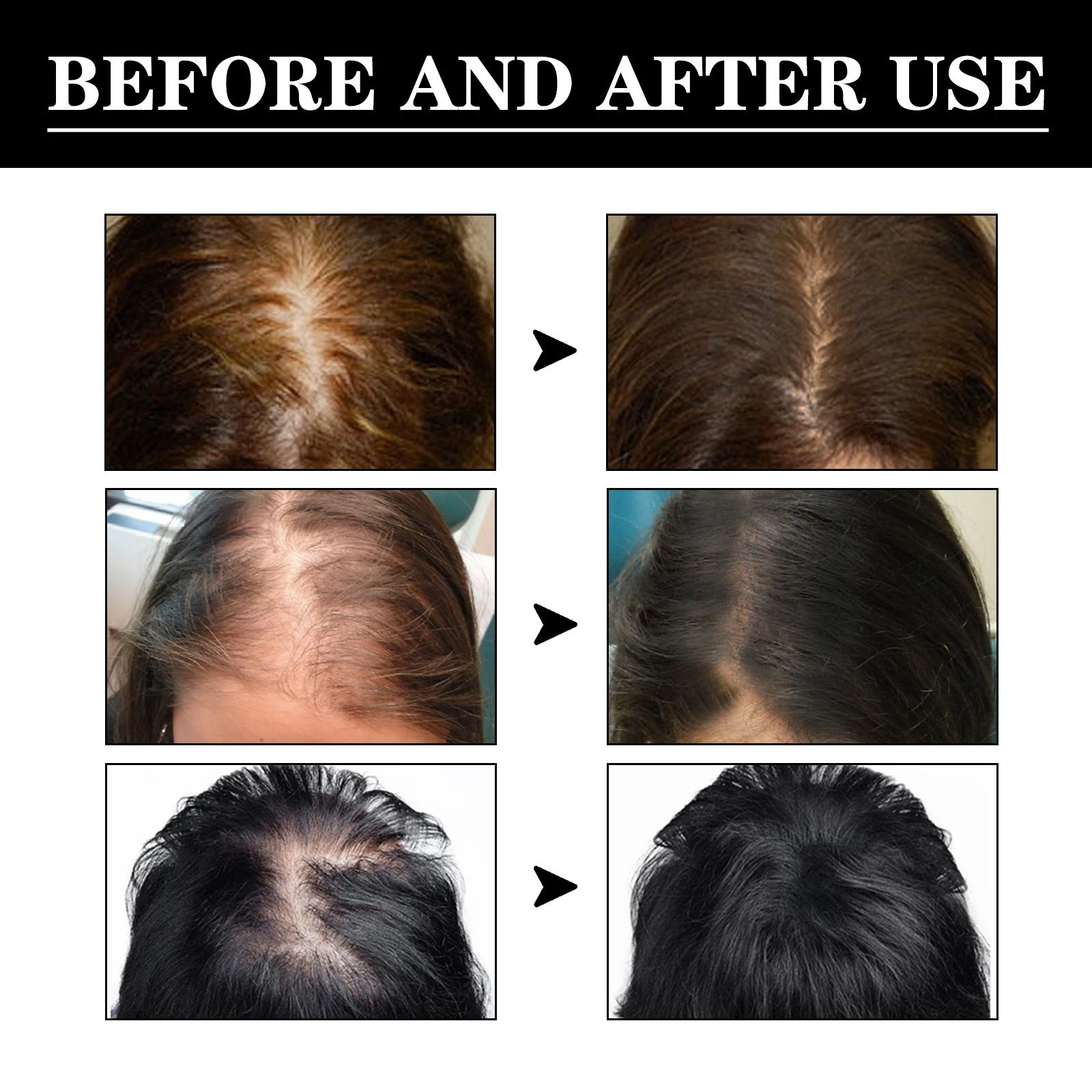 Saç bakım esansı iyi geçirgenl - Hair Care Good Hair incelemesi ve fiyatı