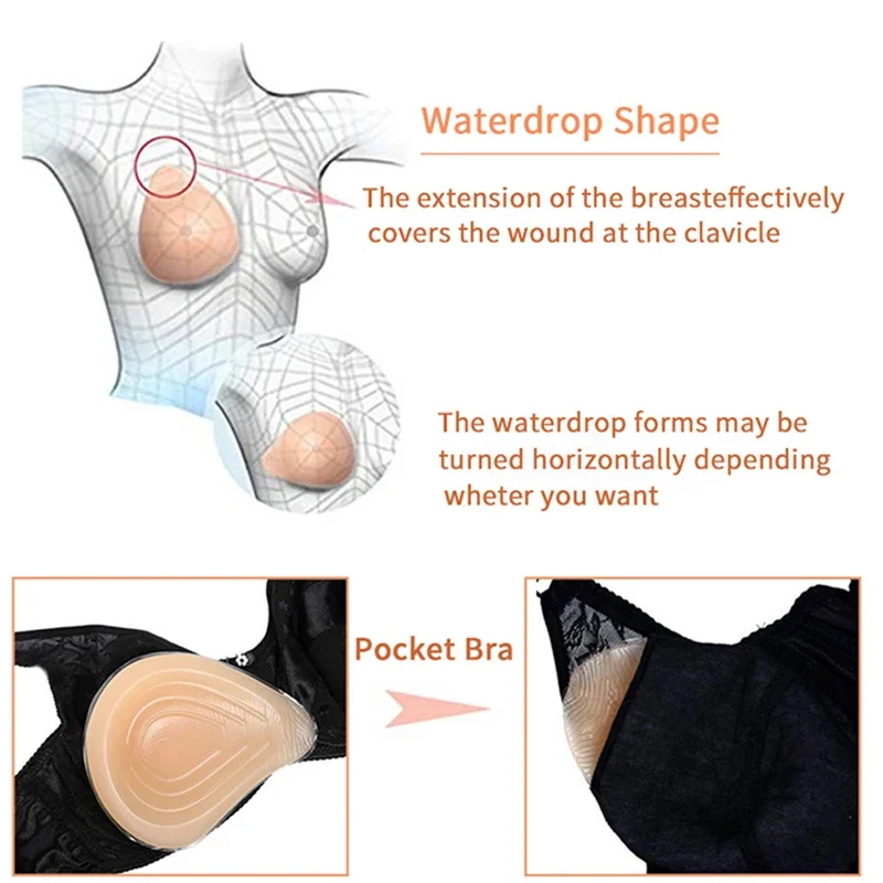 

1 шт., спиральная форма, послеоперационная силиконовая форма для ложной груди, искусственные вогнутые подушечки для увеличения груди, протез для мастэктомии
