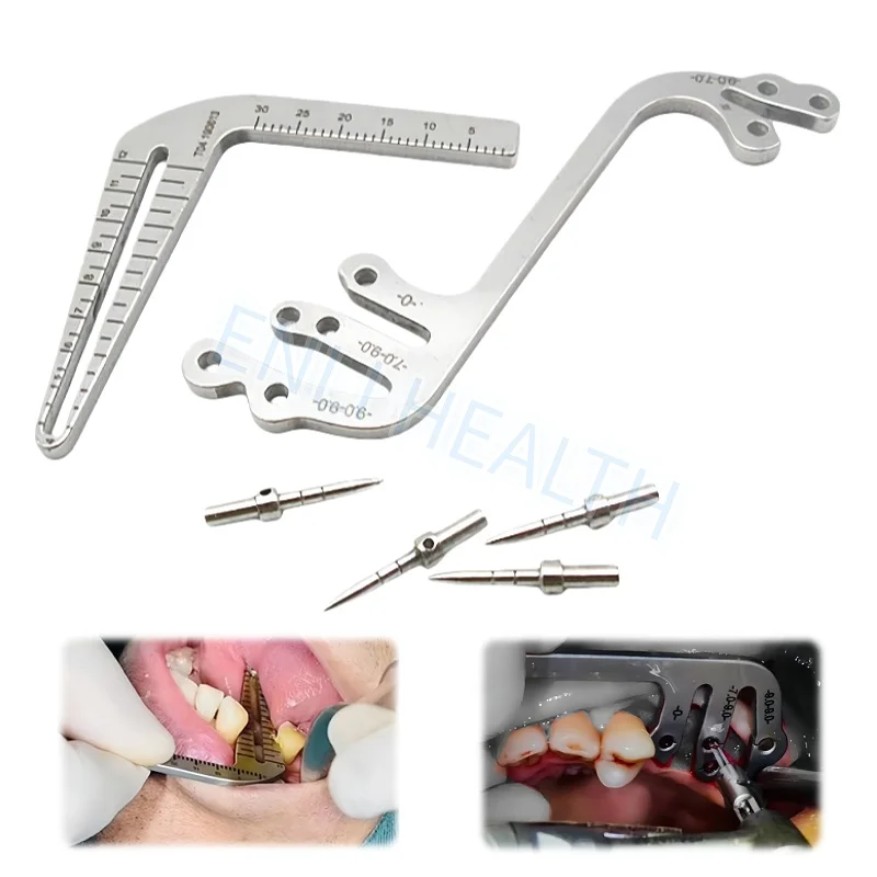 Dental Implant Guide Set Autoclavable Planting Locator Guide Drilling Positioning Ruler Angle Ruler Dental Implant Tools