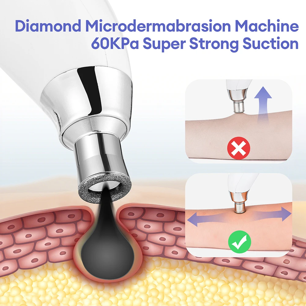 Draagbare Diamant Peeling Machine Microdermabrasie Facial Diepe Reiniging Huidverzorging Apparaat Peeling Vacuüm Mee-eter Remover