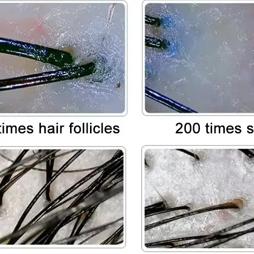 10 Polegada lcd detector de couro cabeludo digital analisador de pele do cabelo microscópio para testes de folículo capilar e análise de pele lupa 50/200x