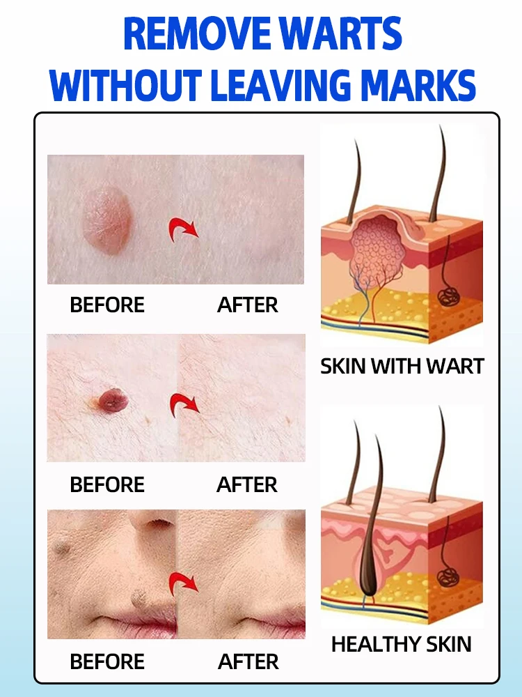 rozwiąż problemy z skórą w ciągu 7 dni