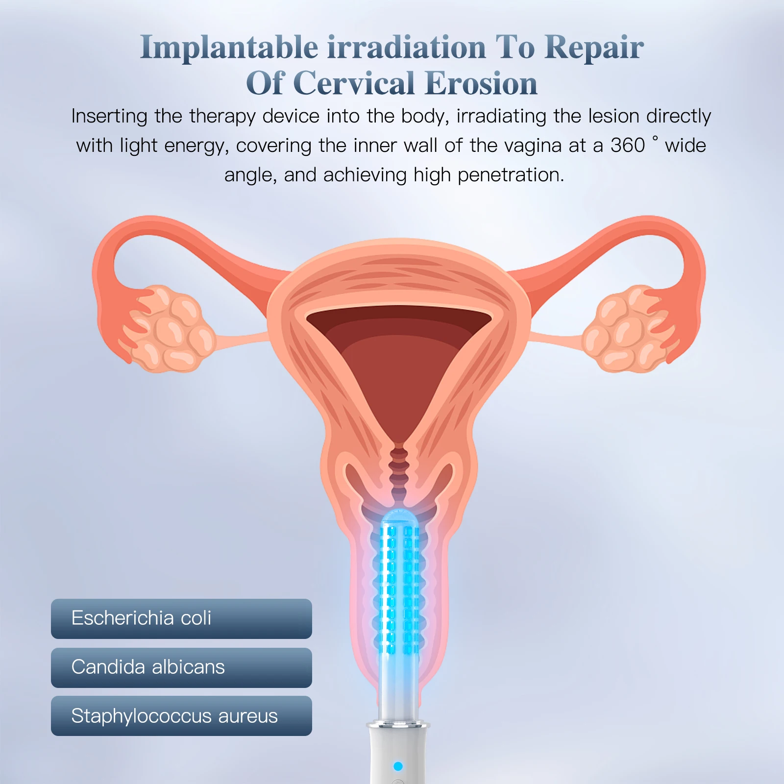 KTS Vaginal Vibrator Wireless Vaginal Massager Red Light Therapy Device for Vaginitis Female Sex Wand Vaginal Tightening Device