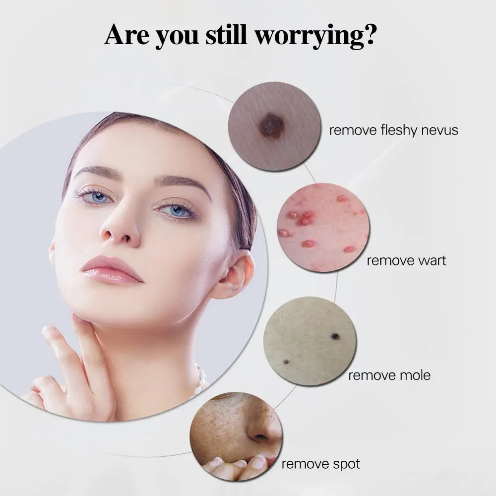Mole Remover Plasma Pen Laser Ion Pen for Fibroblasts PAA Ozone Eylid Pull Plasma Tattoo Freckle Mole Anti Wart Plasma Pen