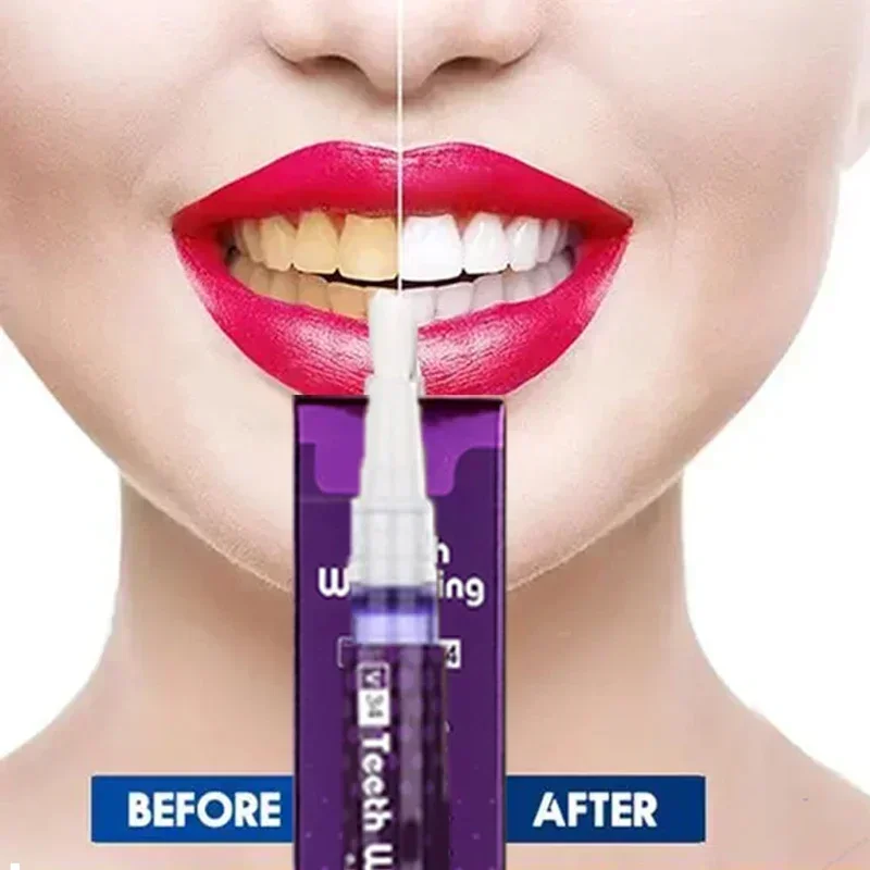 Tooth Whitening Pen Dazzling White Teeth Whitening Pen Instant Teeth Whitening Pen Brighten Your Smile Tooth Hygiene Care Tools