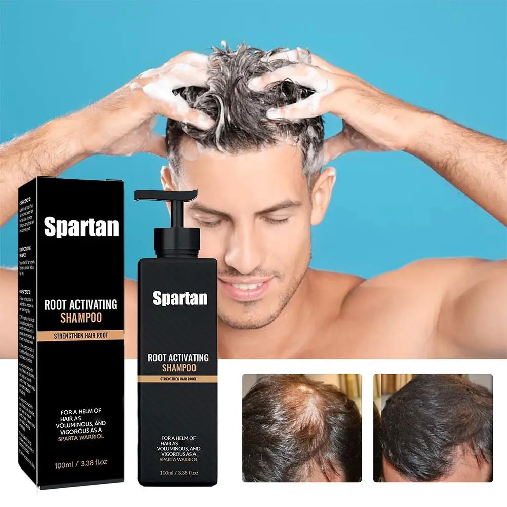 سلسلة شامبو للعناية بالشعر من الجذور والتحكم في القشرة وتقليل النباتات النقية الهشة وتقوية جذور الشامبو لتساقط الشعر F0W9 #6