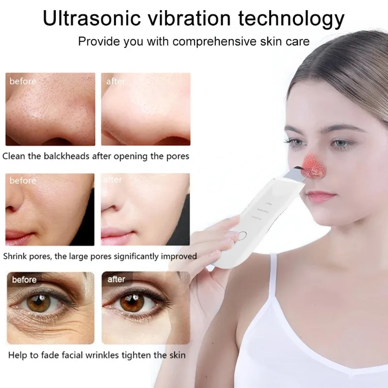 Ultrasone Mee-Eter Schep Huid Scrubber Peeling Mee-Eter Verwijderaar Diepe Reiniging Gezicht Porie Zwarte Kop Acne Schoonheidsapparaten Tool