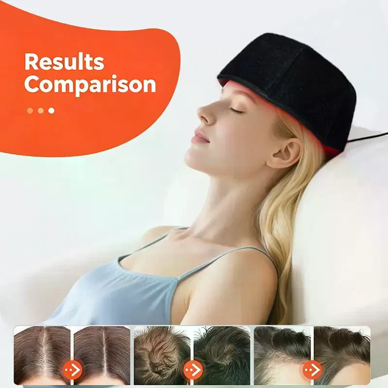 1 Set USB Charging Red Light Therapy Device 660nm 850nm Red & Infrared Light Hair Growth Cap Hair Loss Treatment