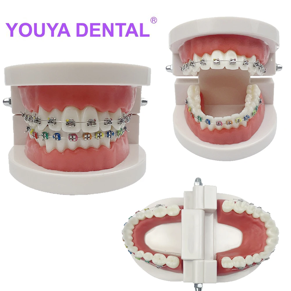 

Dental Orthodontic Typodont Teeth Model With Half Self-Ligating Metal Bracket Lingual Retainer Ligature Dentistry Demo Model