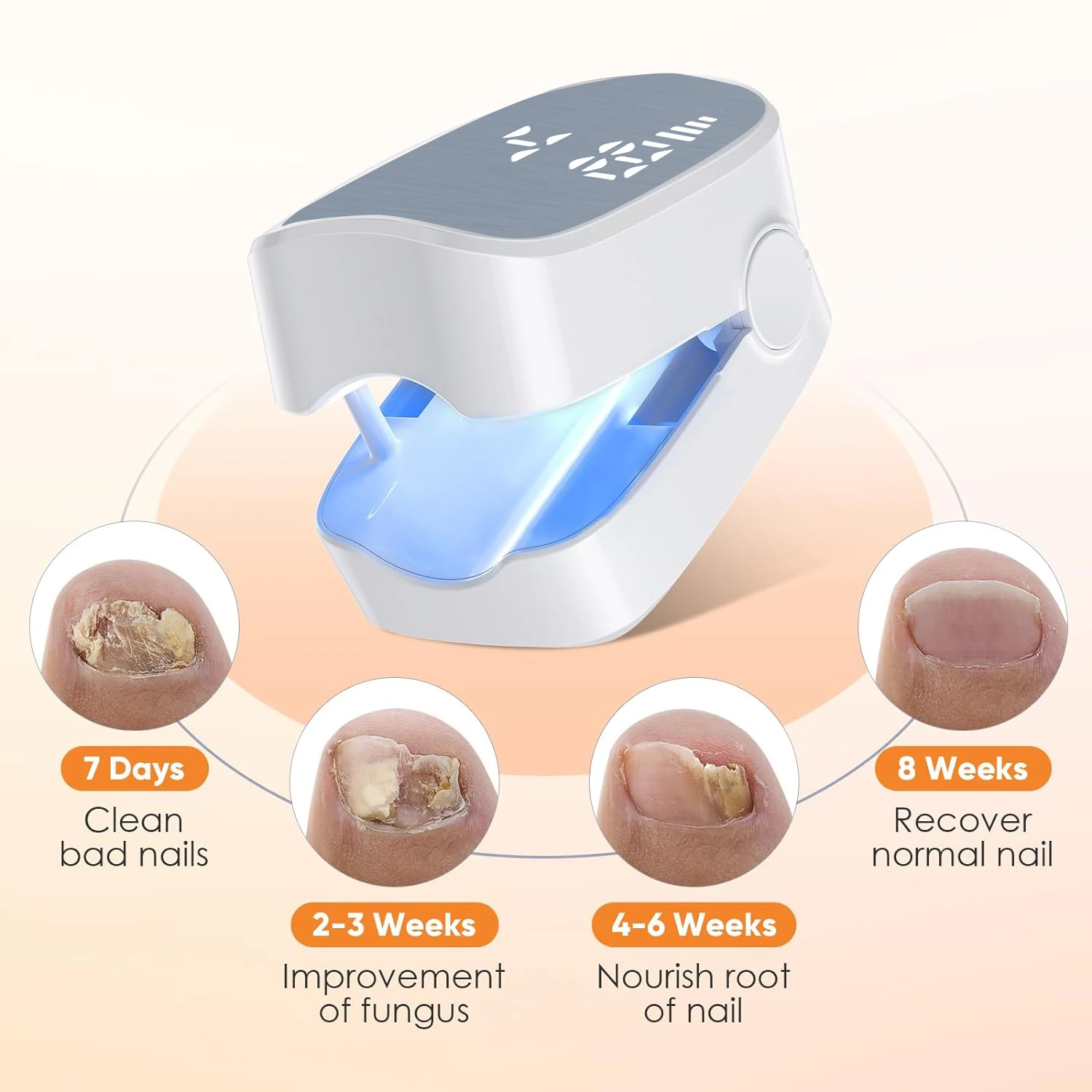 Nail Fungus Cleaning Light Device for Onychomycosis USB Nail Fungus Laser 905nm Infrared Light 470nm Blue Light NailSalon view 2
