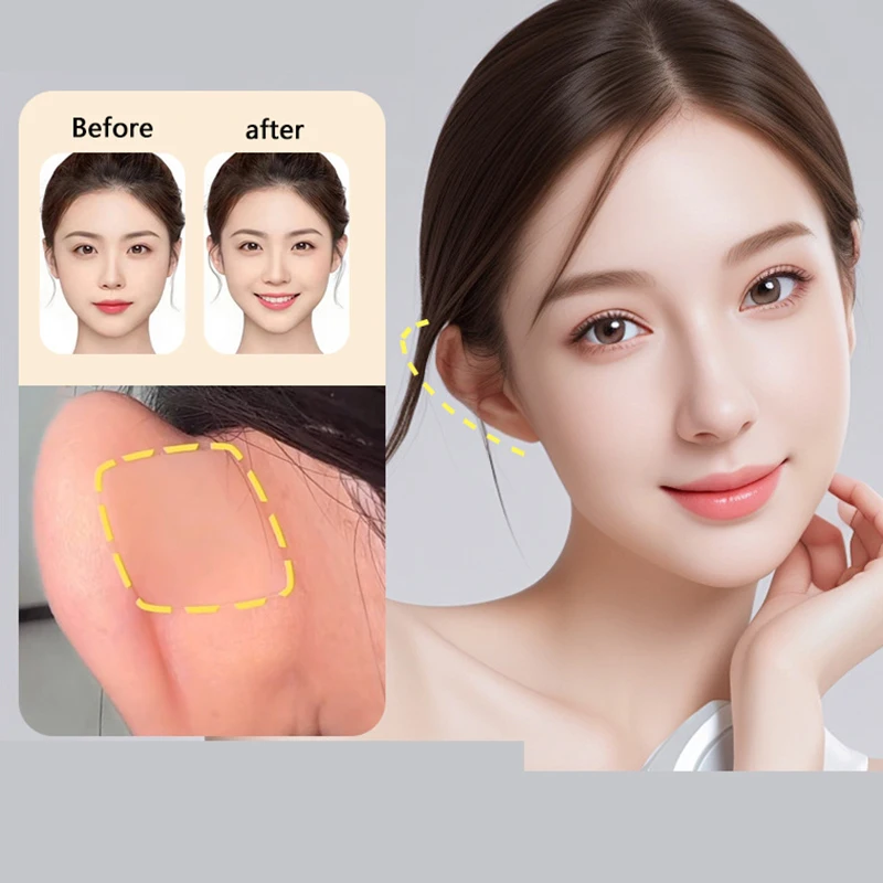 Silicone Elf Ear Patch V-Face Ear Stand Reusable Strong Support Fixed Invisible Earrings Protruding Prominent Correction