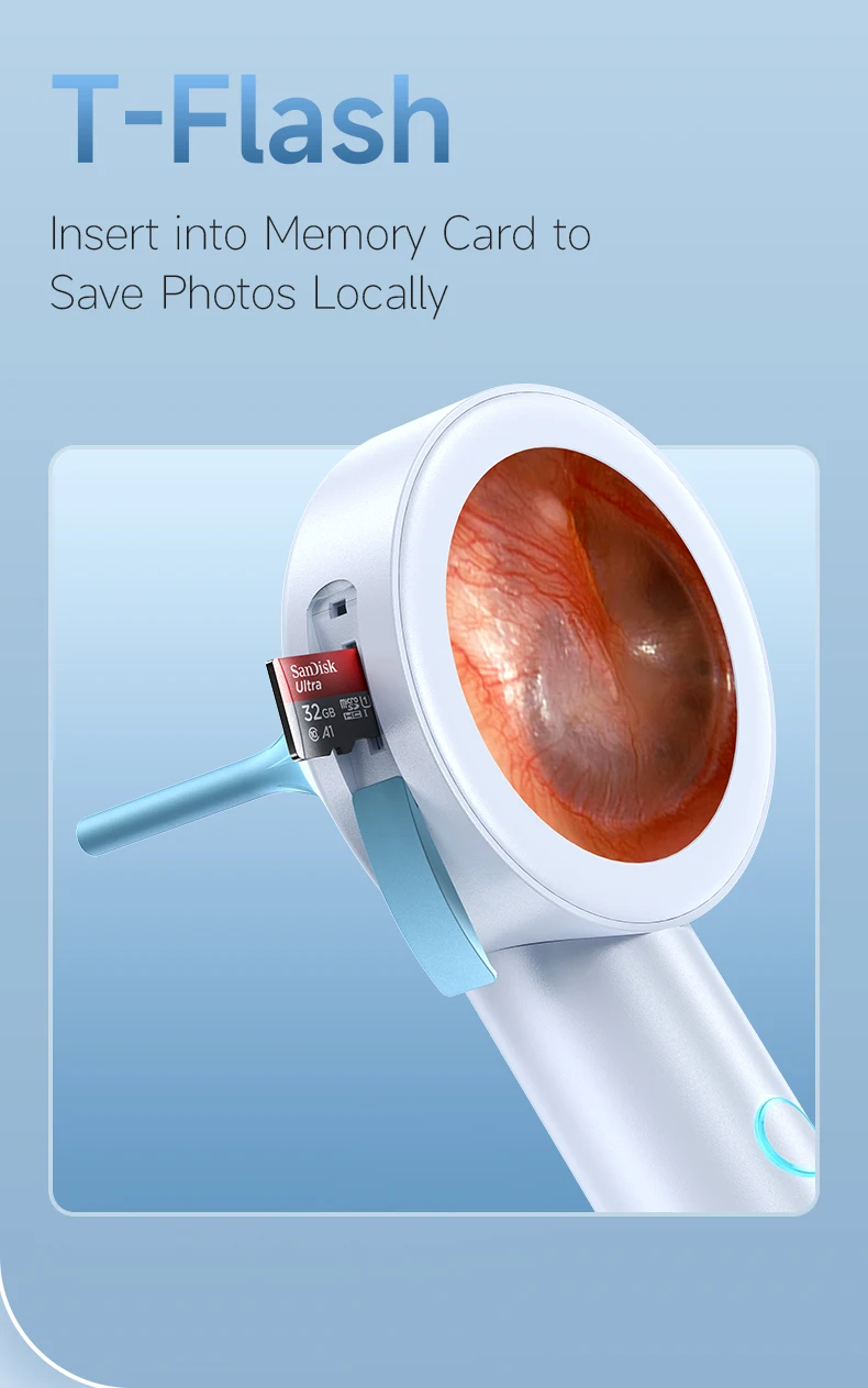 Ear Cleaner Camera with Screen 1080P Otoscope Ear Wax Removal Tool for Kids Adults & Pets 1.8’’ Screen LED Light Safe Ear Picker