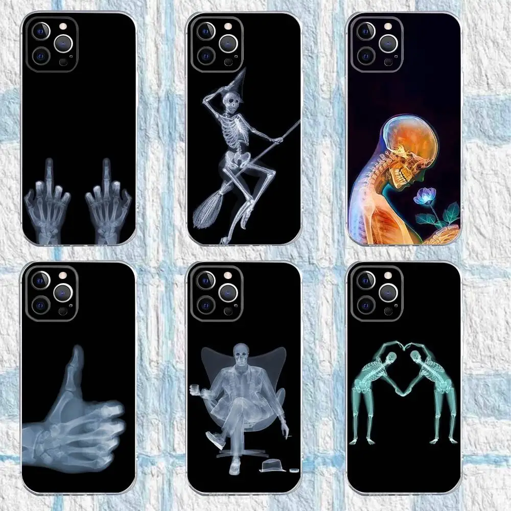 حافظة هاتف X-RAY هيكل عظمي شعاعي لهاتف آيفون 16,15,14,13,12,11 Pro,Max,Plus,X,XS,XR,SE,سيليكون شفاف صغير ناعم
