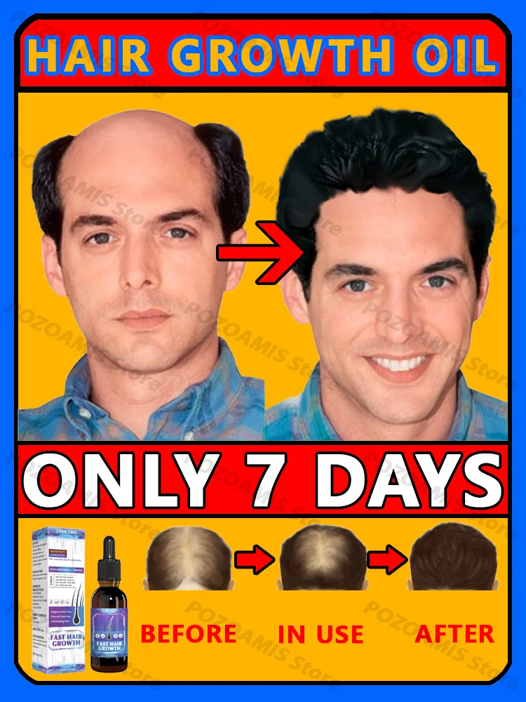 99% repurchase, more and more hair, say goodbye to baldness, hot selling product