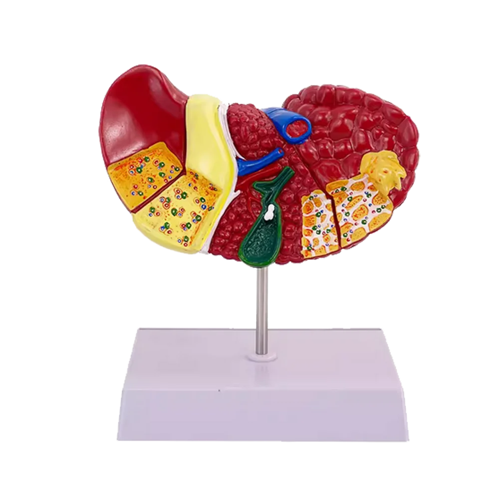 Medical Science Colored Pathology Liver Anatomical Model