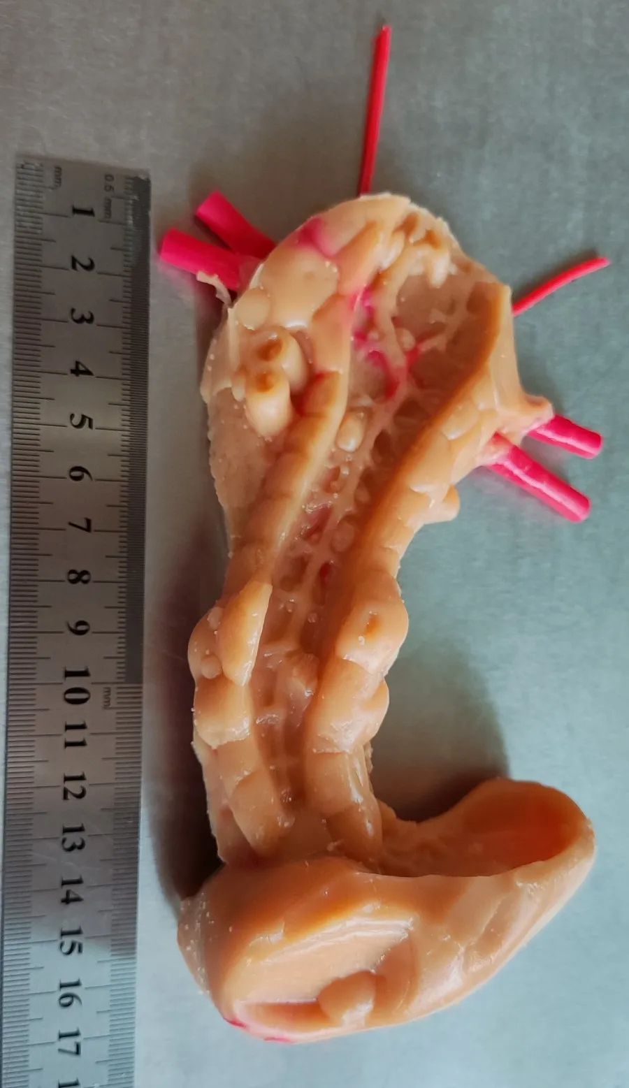 

Pancreas and spleen built-in bionic tube module (pathology)