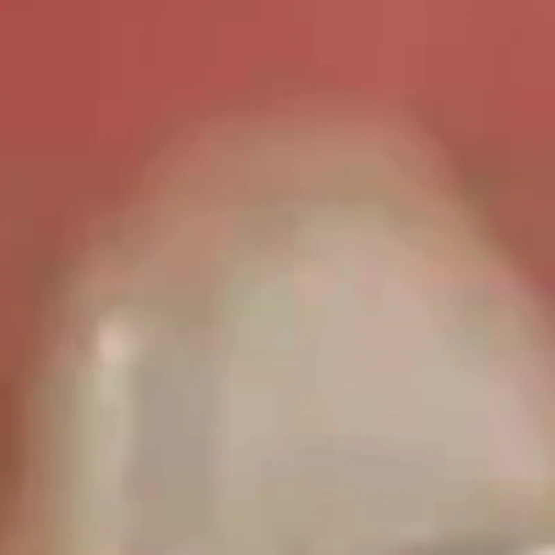 

1 шт., стоматологические ортопедические задние кронштейны, буккальная трубка, склеивающийся держатель для пинцета, шарнирная бумага, пинцет, инструменты, плоскогубцы