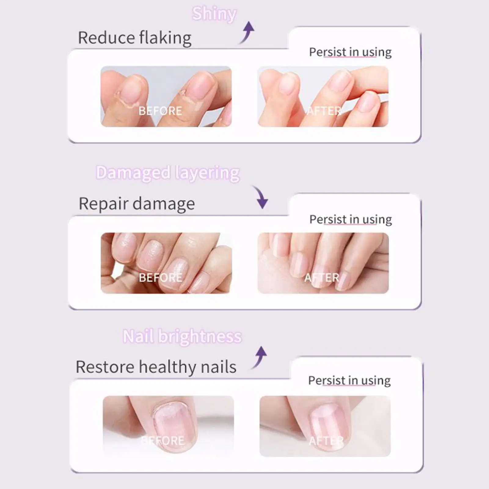 보습 네일 오일 펜, 강력한 손톱 강화 오일 펜, 손상된 손톱 영양 관리 용품, 큐티클 오일