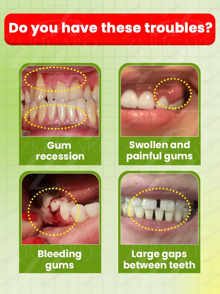 Soothing drops solve the problem of gum recession, relieve toothache and protect oral health