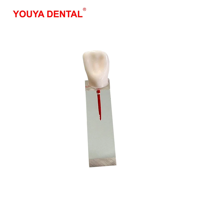 6 adet restorasyon diş eğitim modeli endodonti kök kanal blok reçine Endo diş modeli eğitim uygulama hamuru boşluğu RCT