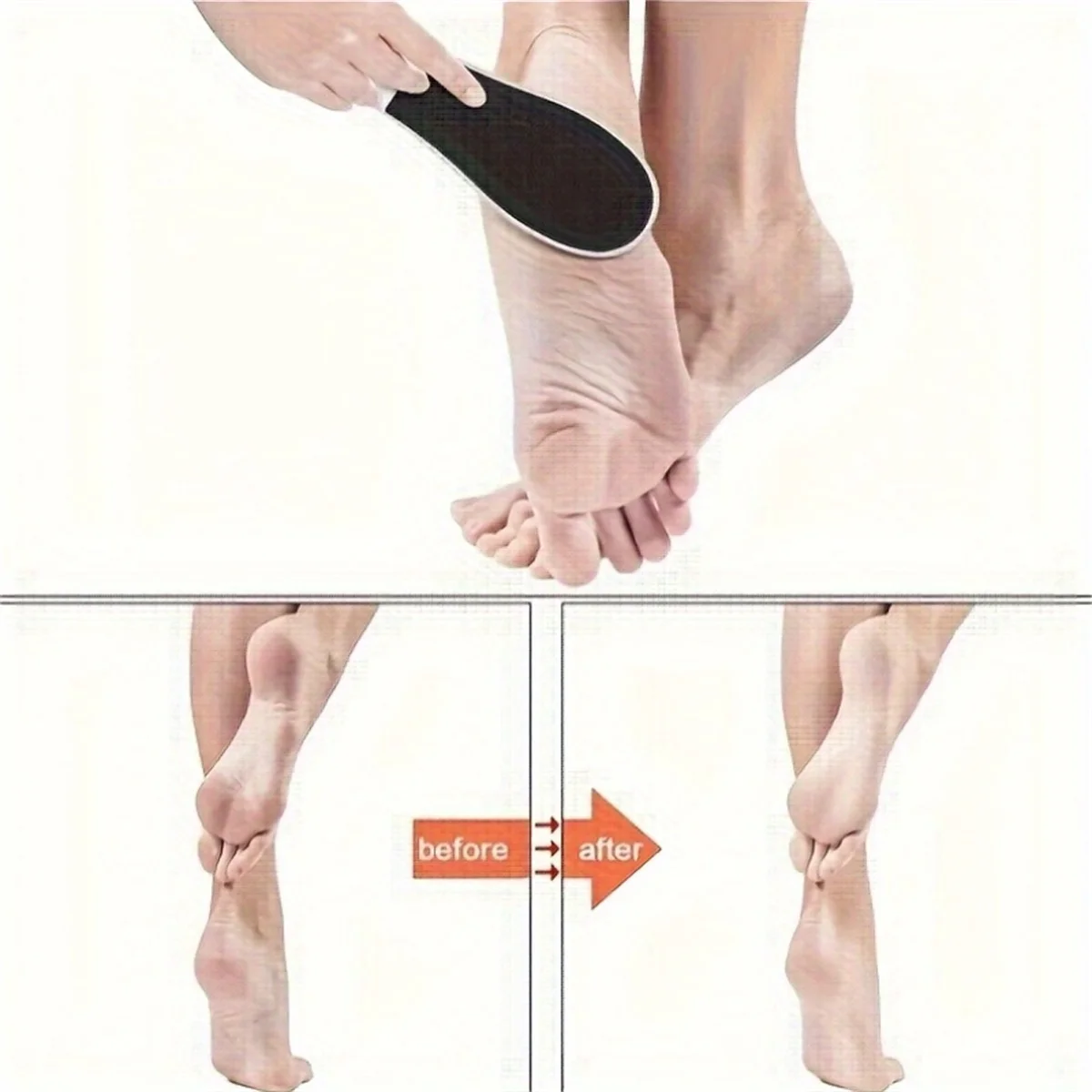 Thumbnail 3 - #15 Latest Callous Removers Offers
