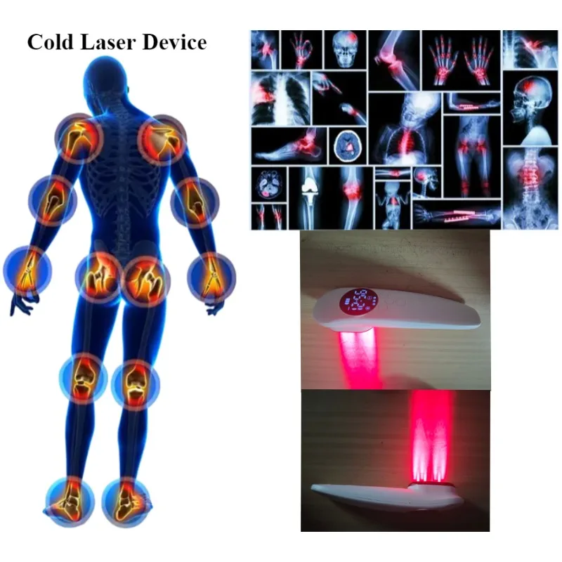 

Medical Grade Red Light Therapy for Arthritis, Neck & Back Pain Relief Photobiomodulation therapy device