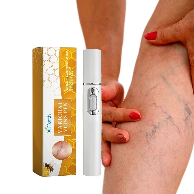 Stylo de réparation des jambes pour thérapie au laser, produit de soin de la peau, SAP imconfortable pour les jambes, améliorant le surpoids sanguin, stylo pour varices