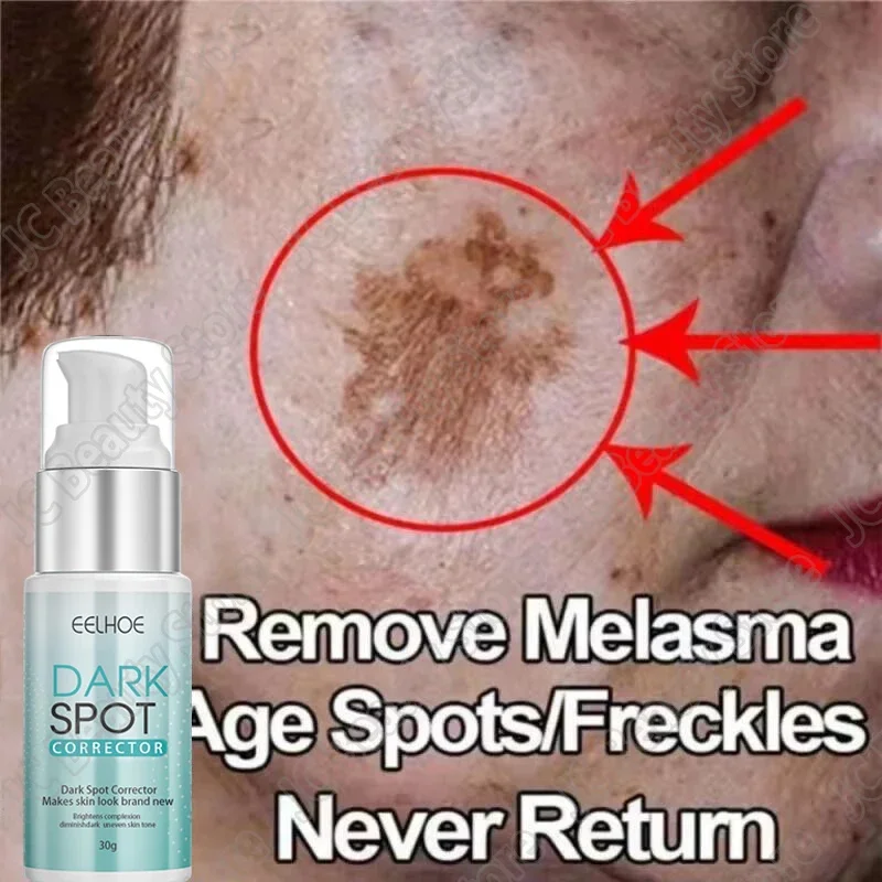 

Powerful Spot-removing Whiten Cream Brighten Skin Fast Eliminates Melanin Pigmentation Melasma Dark Spots Moisturize Skin Care