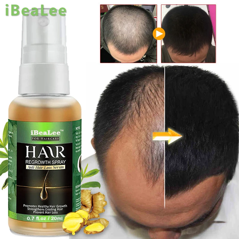 

Fast Hair Growth Products Ginger Anti Hair Loss Serum Spray Prevent Baldness Treatment Scalp Beard Beauty Hair Care Men Women