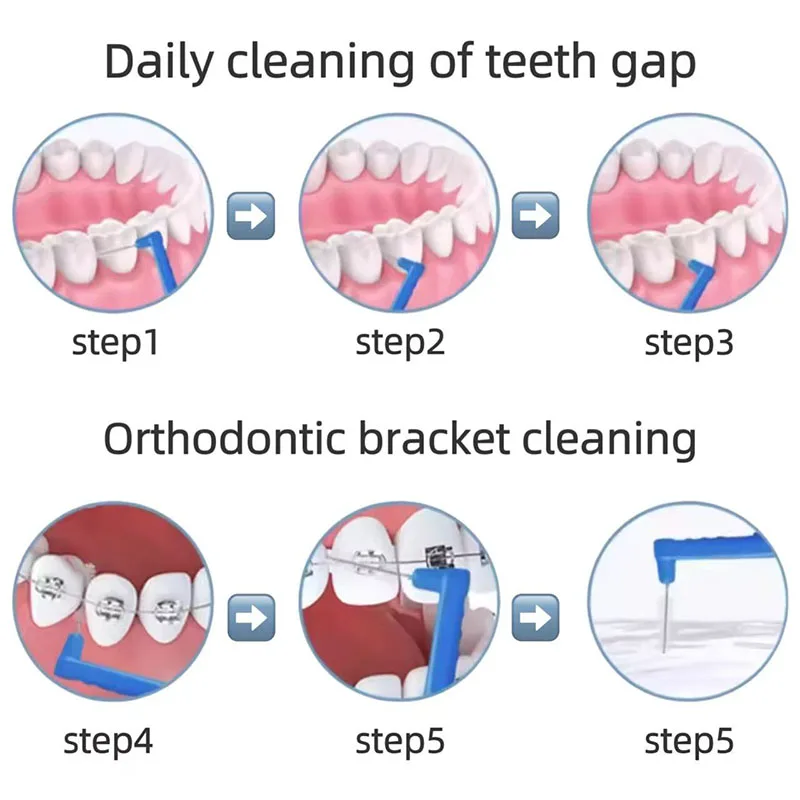 فرش بين الأسنان نظافة الفم خيط تنظيف الأسنان L شكل مسواك لينة تقويم الأسنان الأسنان صحية فرش الأقواس فرشاة الأسنان