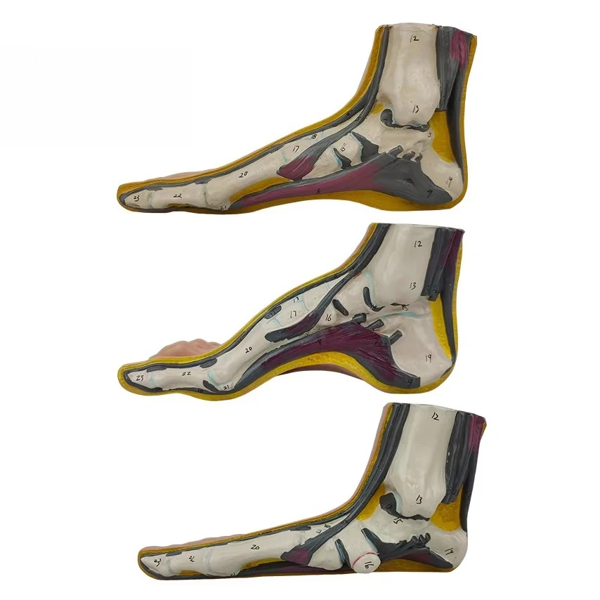 Foot compatibele Arch Normal Flat Foot Anatomical Teaching Model