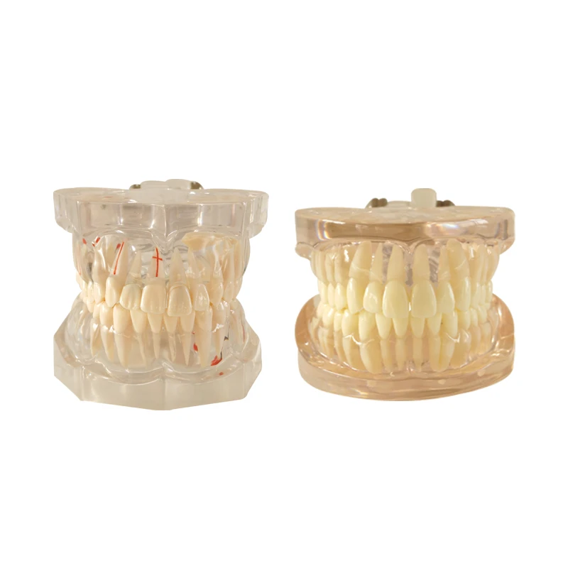 

Dental Teeth Model 4 Times Periodontal with Nerve Model Teeth Model Teaching Study Demonstration Tool Dental Materials