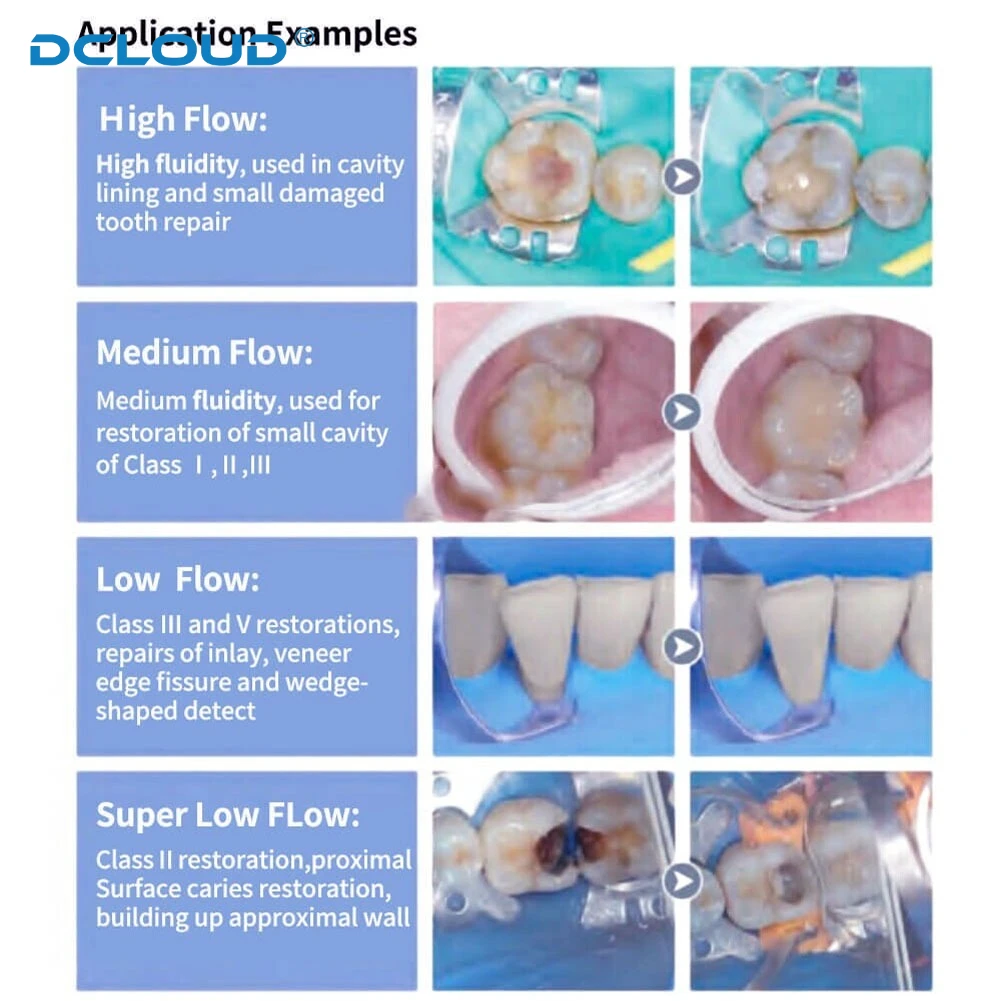 Dentex 3g/Pc Flow Light Curing Dental Composite Resins Teeth Filling Material Micro Hybrid Flowable Resin for Crown Restoration