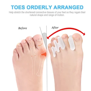 Ayak için 6 büyük satış ortezi-no. 6