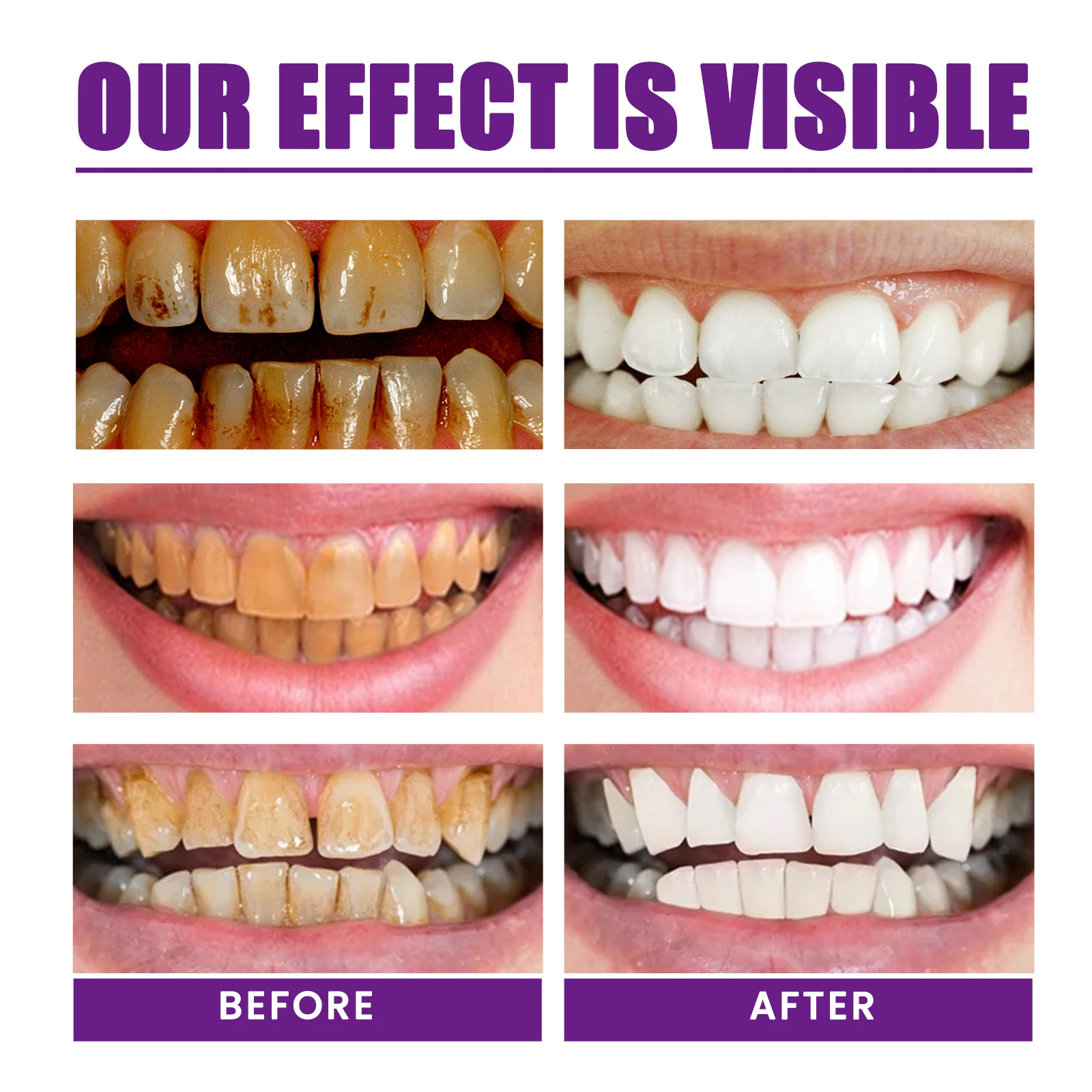 Purple Toothpaste Removes Tartar Purple Toothpaste for Correcting Tooth Color Cleans  Hygiene Freshens Breath Reduces Yellowing