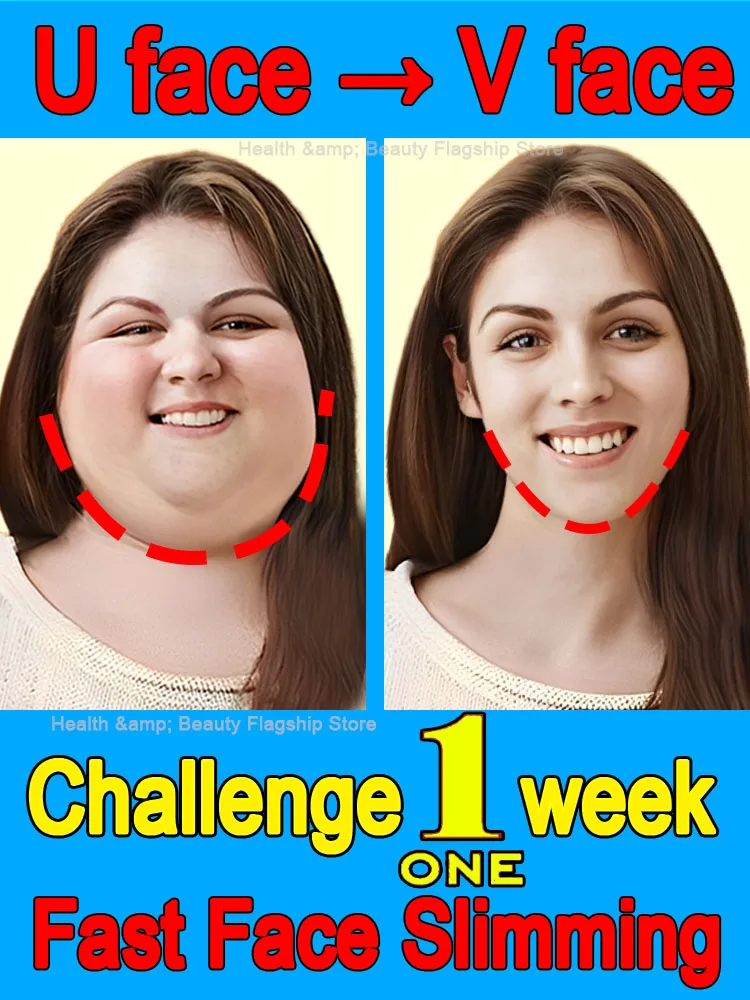 Double Chin Removal