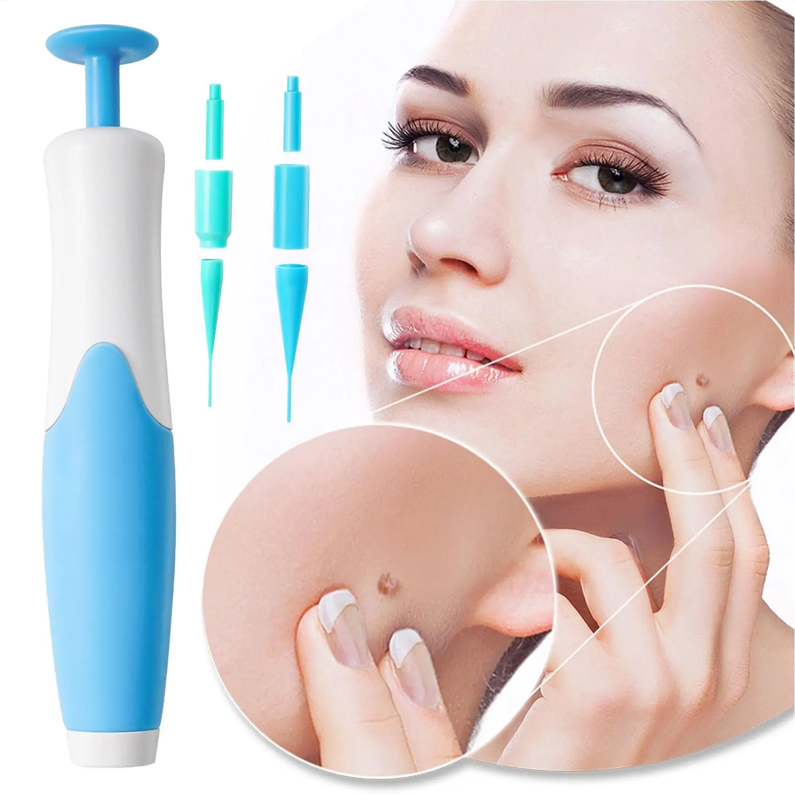 Upgraded Skin Tags Removal Kit 2 Removal Head for Small to Large 2mm to 8mm Sized Skin Tags Remove Skin Tags from Face and Body