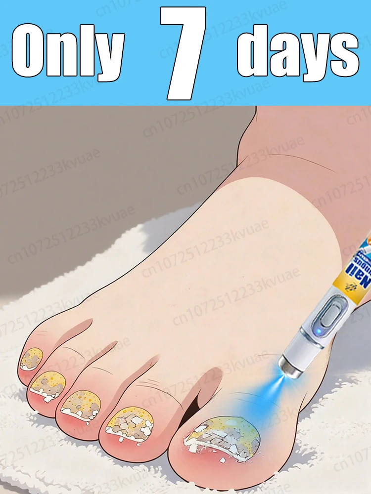 

Скажи прощайте на онихомикоз с научными методами