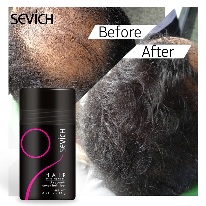 10 Color Hair Fibers Keratin Hair Building Fiber Instant Regrowth Powders Hair Loss Conceale Hair Growth Product for Men & Women