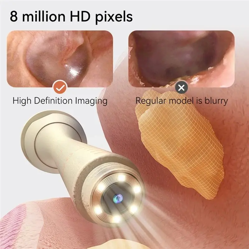 B02C-Replacement Ears Wax Cleaner Kit 8M HD Camera Visual Earwax Removal Tool For Whole Family